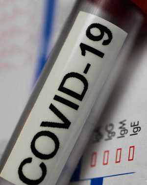 Анализ на антитела к коронавирусу (Coronavirus SARS-CoV-2)